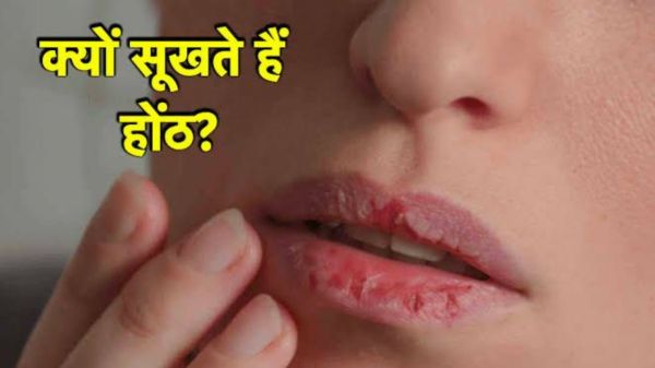 इन कारणों के वजह से बार-बार सूखते हैं होंठ, इस विटामिन की हो सकती है कमी&hellip;